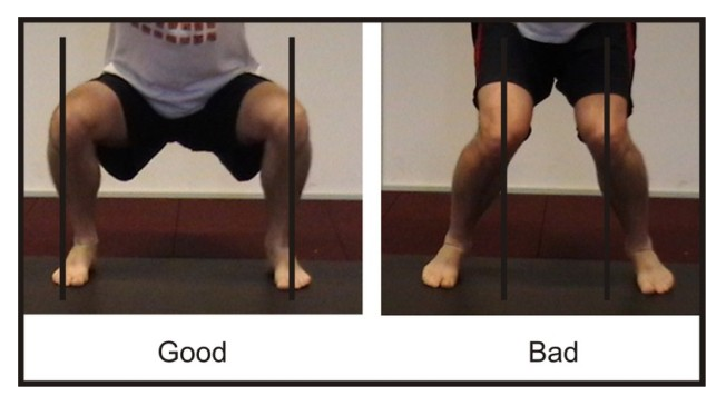 Knee Taping Helping Your Squat- Keeping Your Knees From Caving