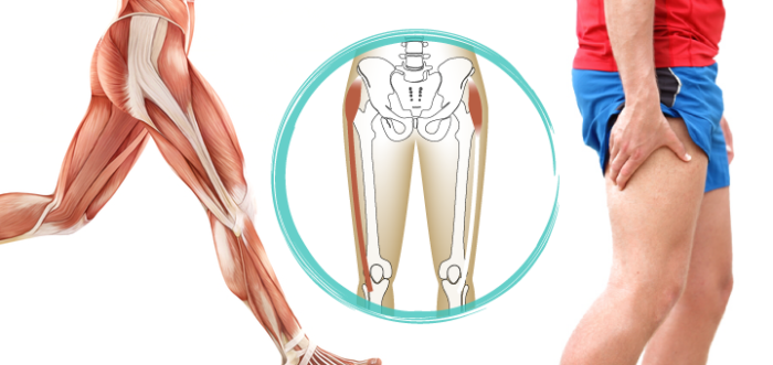 Why Your IT Band SHOULD be tight! - Invictus Fitness